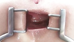 XXL wide butthole wants big dick